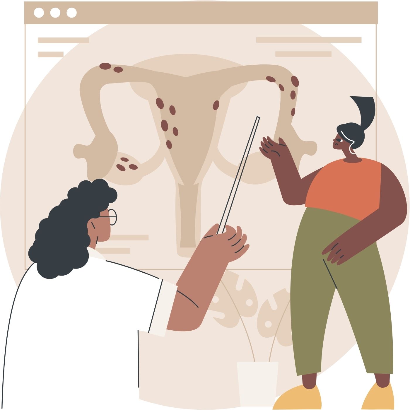 Ilustración de ovario y útero con lesiones de endometriosis, dos figuras femeninas señalan la ilustración