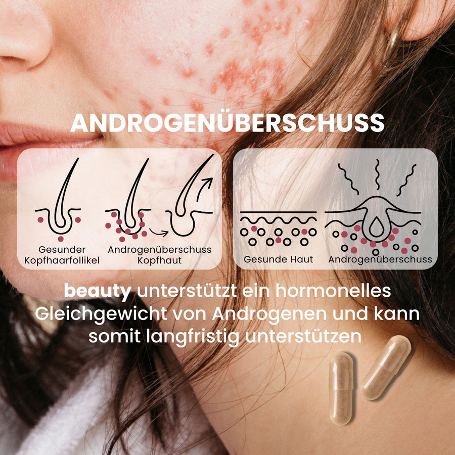 Androgenüberschuss fenou beauty
