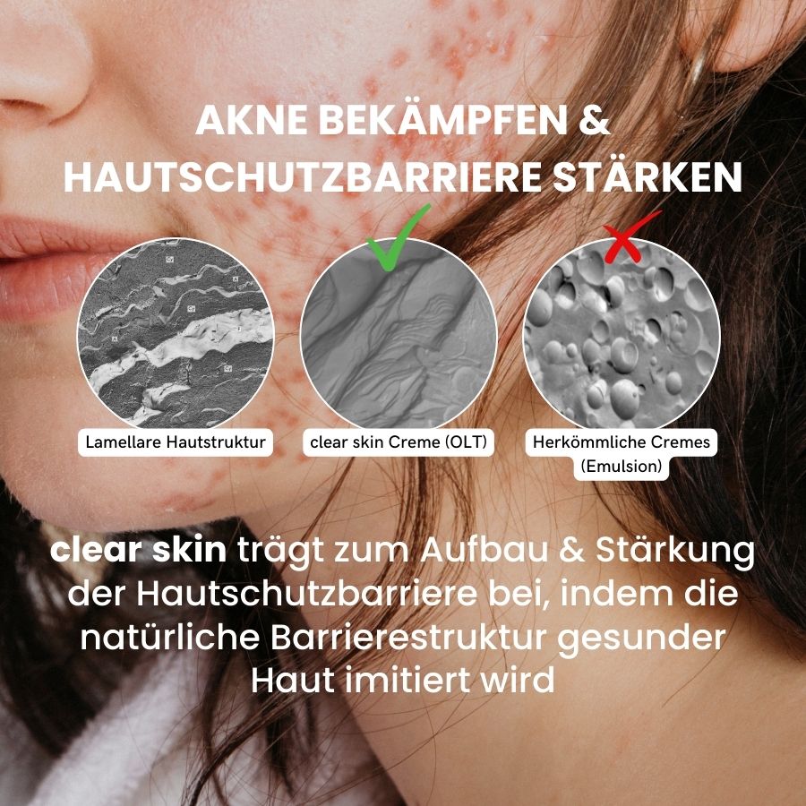 Infographik über Hautstruktur und mikroskopische Struktur von Cremes