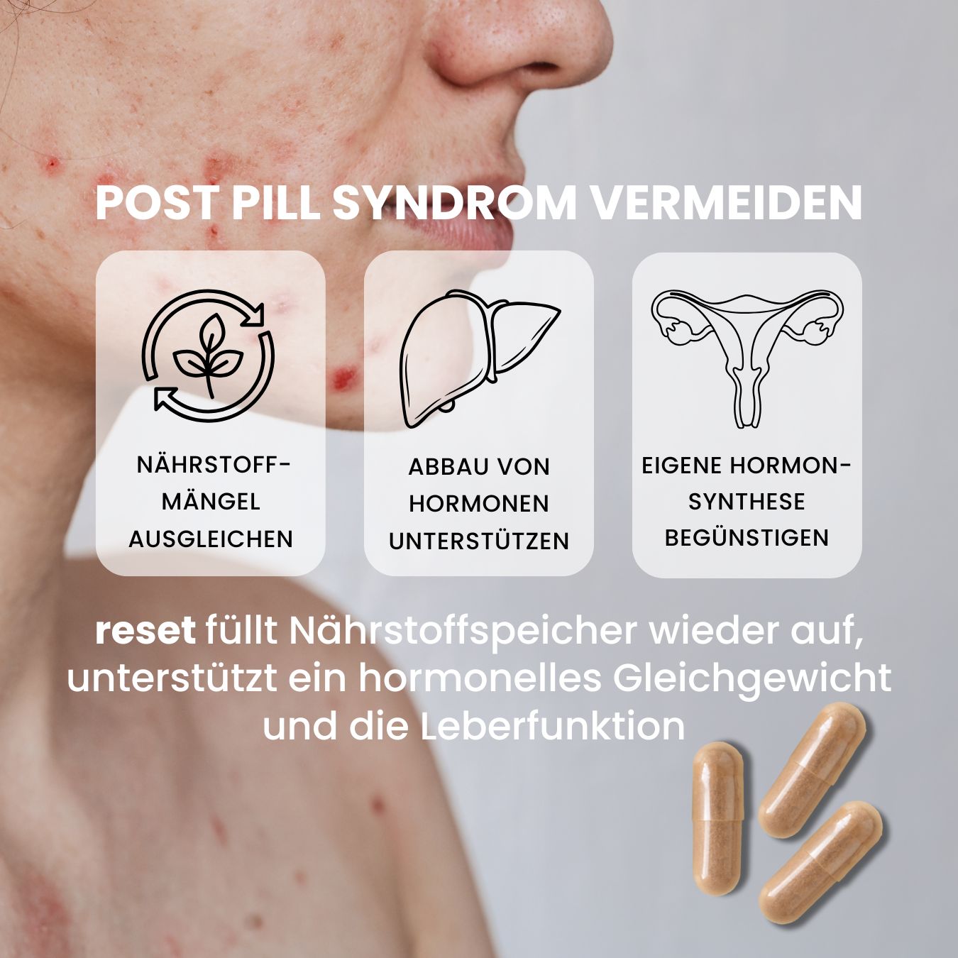 pille absetzen reset unterstützt bei post pill syndrom