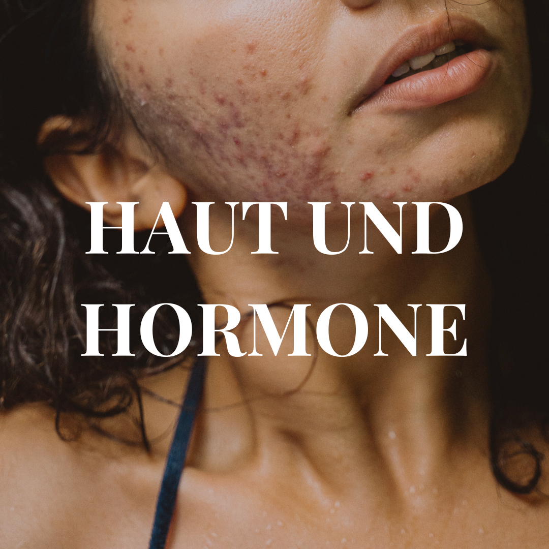 Hormonelle-Akne-Pickel-Hautprobleme