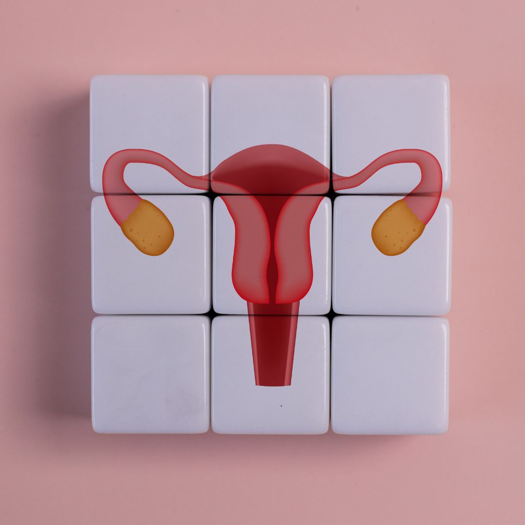 PCOS und Darmgesundheit: Der versteckte Zusammenhang, der alles verändert