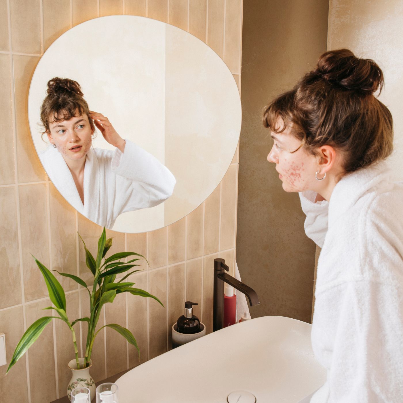 Post-Pill-Akne: Warum Pickel normal sind und wie du deine Haut unterstützt
