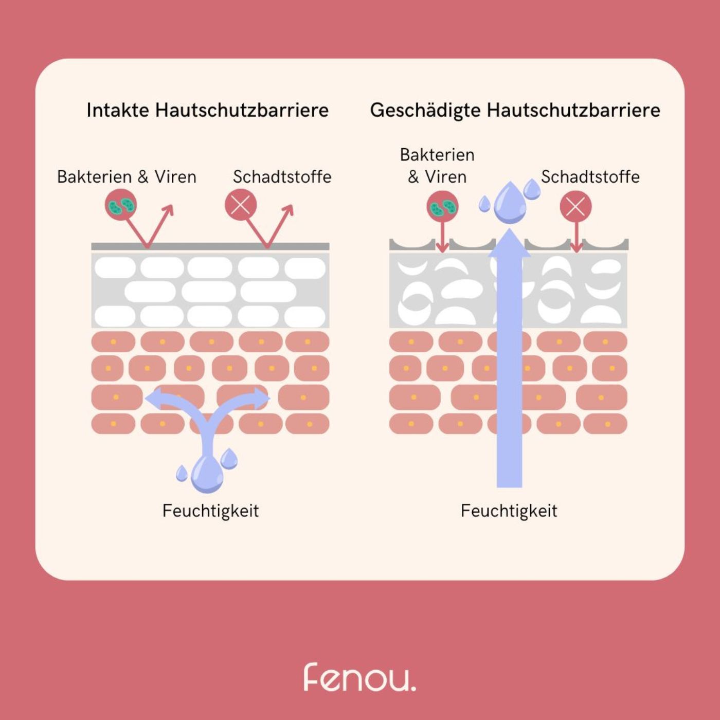 vergleichende Darstellung von Haut mit intakter und geschädigter Hautbarriere. fenou, was tun für reine haut, schöne haut bekommen