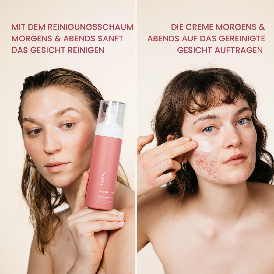 ein weiblich gelesenes Model mit Akne hält einen fenou clear skin Reinigungsschaum, ein anderes Modell mit Akne cremt sich das Gesicht mit fenou clear skin Creme ein